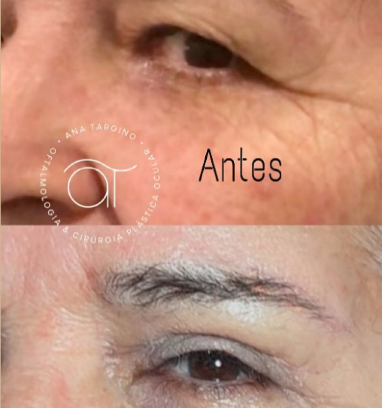 Oftalmologia e Cirurgia plástica ocular em Maceió al